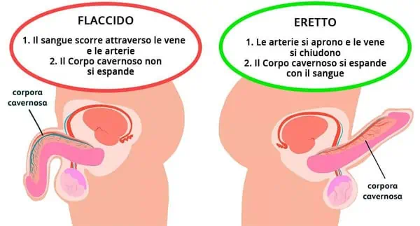 Cosa vuol dire disfunzione erettile e come curarla